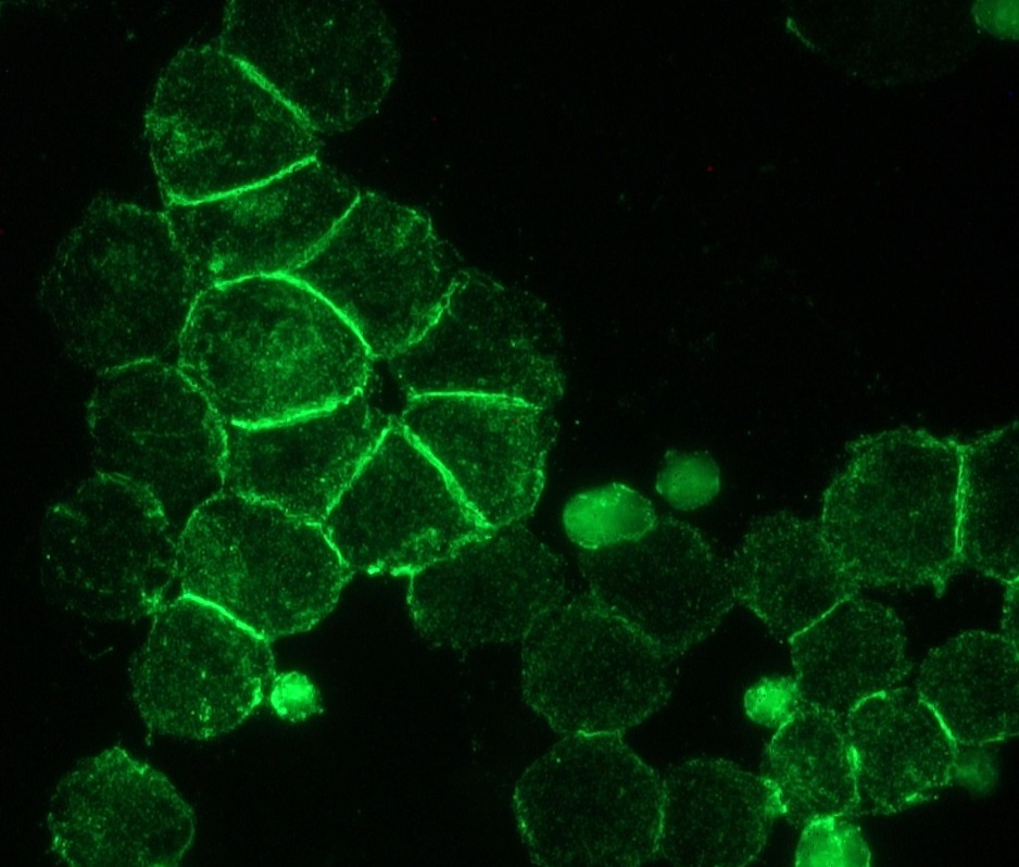 Figure 1. Immunohistochemistry of MUB1300P (RNL-1) on H82 cells, derived from small cell lung cancer, showing strong positive staining for NCAM/CD56 at the sites of intracellular connections. Dilution 1:500.